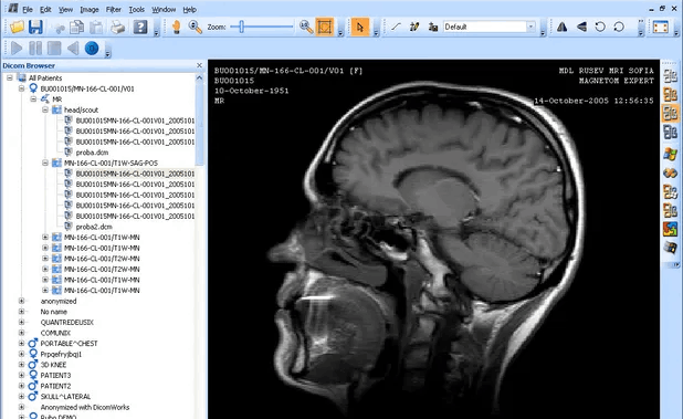 kftech desktop dicom viewer
